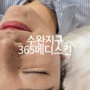제12회 광주합창제 | 광주 수완지구 여드름 피부 모공관리샵 '365메디스킨' 플라즈마 12회 내돈내산