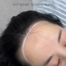진헤어라인 네이버블로그