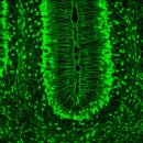 글리아(GLIA)