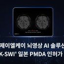 제이엘케이 이미지