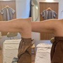 치유인청담모노스킨 - 관악구 신림로 264 | 치유인청담 웨이브온으로 페이스,팔뚝 웨딩관리 후기 내돈내산