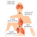 고혈압낮추는방법 고혈압에는 역시 청국장 이미지