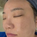 여름철 피부관리 추천, 역북동 에스테틱 골드스킨라이프에서 받은 모공관리 후기