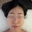 조이댕댕 | 낙성대 피부관리 조이약손에서 자극없는 윤곽관리!