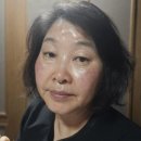 연승열헤어클럽 | 두피 열 -7.4℃! 에잇그로우 B5 헤어토닉 솔직 후기