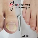 레푸스익산 이미지