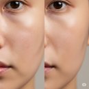마장제일의원 네이버블로그