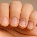 손톱으로 확인하는 내 몸 건강 신호 4가지 이미지