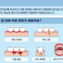 큰사랑치과 네이버블로그