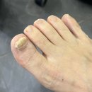풋스올 당산점에서 발 각질 관리, 발톱 관리 후기