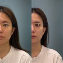 트로이아르케 | 김해에스테틱 작은얼굴관리 받고 힐링하고 온 트로이아르케 후기