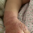 이승훈외과의원 | 양주시 피부병 명의 아토5분