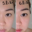 [공지] 네번째 다섯번째 여섯번째 밀려버린 나의 화이트태닝 후기 배곧태닝샵 발리브라운 4탄인가요??