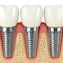 위례양치과의원 이미지