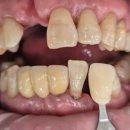 복음치과기공소 이미지