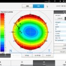 프렌즈안경 이미지