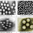 노로바이러스 증상 전염 원인 치료 이미지