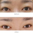 [춘천속눈썹펌] 임뷰티 춘천점 솔직후기