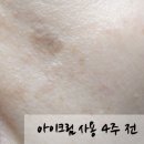 기미 검버섯 없애는법 with 스와니<b>코코</b> 아이크림, 미소<b>제인</b> (to.별안간애)