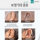 하단독일보청기 이미지