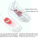 표층의 발 내재근 - 5개 이미지