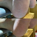 사림동147 | 창원대네일 사림동 뽀샵 패디플래닝 발각질제거 솔직후기