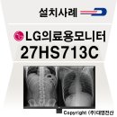 [27HS713C] 아산 소재 정형외과 LG 의료용 모니터 설치사례 -판독용 모니터, 임상용 모니터