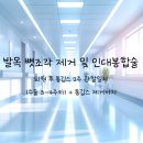+응급실썰) 발목 뼛조각 제거 및 인대봉합술 퇴원 후 통깁스 2주 관찰일지(3-4주차)