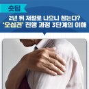 [오십견’ 진행 과정 3단계의 이해] 2년 뒤 저절로 나으니 참는다? 이미지