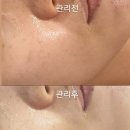 피부꽃피우다