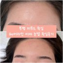 미헤어라인 - 철원군 | 부평역왁싱 꼼꼼한곳 미무드 헤어라인+이마+눈썹 왁싱 솔직후기