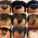 압구정연세의원 이미지