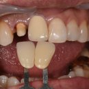 CORE 치과기공소 이미지