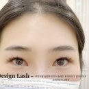 광주디자인연장 자연스럽게 포인트 주는 시술 후기