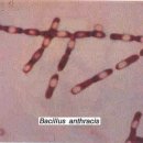 Bacillus anthracis (탄저균) 이미지