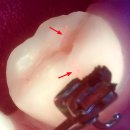 더연세퍼스트치과병원 이미지