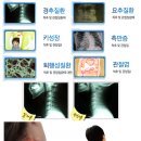 광진의료기 이미지