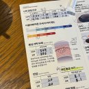 현대성모의원 | [강남성모원안과]스마일 라식•클리어 라식 후기✨👀