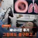 "익사하는 공포라고?" 처음 알게 된 폐내시경 기관지내시경의 과정과 통증 후기
