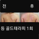 케어셀라 이미지