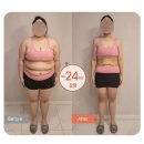 강남-222 | 강남 다이어트 감량 전후 체형변화 체지방 감소 아나하 강남점 후기