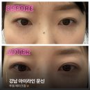 펜타워 PEN TOWER | 경력 대표원장 직접시술로 유명한 투엠메이크업[반영구센터]에서 쌩얼도 또렷해진 무통 아이라인 후기💖