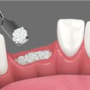 엔젤치과의원 이미지
