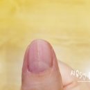 이손네일 - 포항시 남구 | 아픈 엄지손가락 ♡ 다이소 젤 네일 리얼 후기