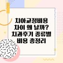 치아사랑치과기공소 | 치아교정비용 차이 왜 날까? 치과후기 종류별 비용 총정리