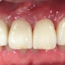 지안치과기공소 이미지