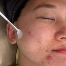 삼일공원로 | 천안 근교 아산 가람뷰티 피부관리샵 추천 여드름 부 고민으로 다녀온 솔직 후기