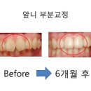 바로이치과 이미지