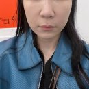 압구정피부과 아기레이저 받으러 연예인피부과 다녀온 후기