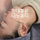 우치로 | 광주 전대 후문 &#39;나노뷰티&#39; 꼼꼼한 스킨플래닝 추천 후기